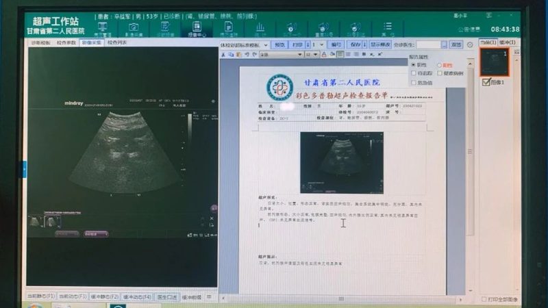 CT加项体检套餐，揭秘其背后的科学依据与选择要点